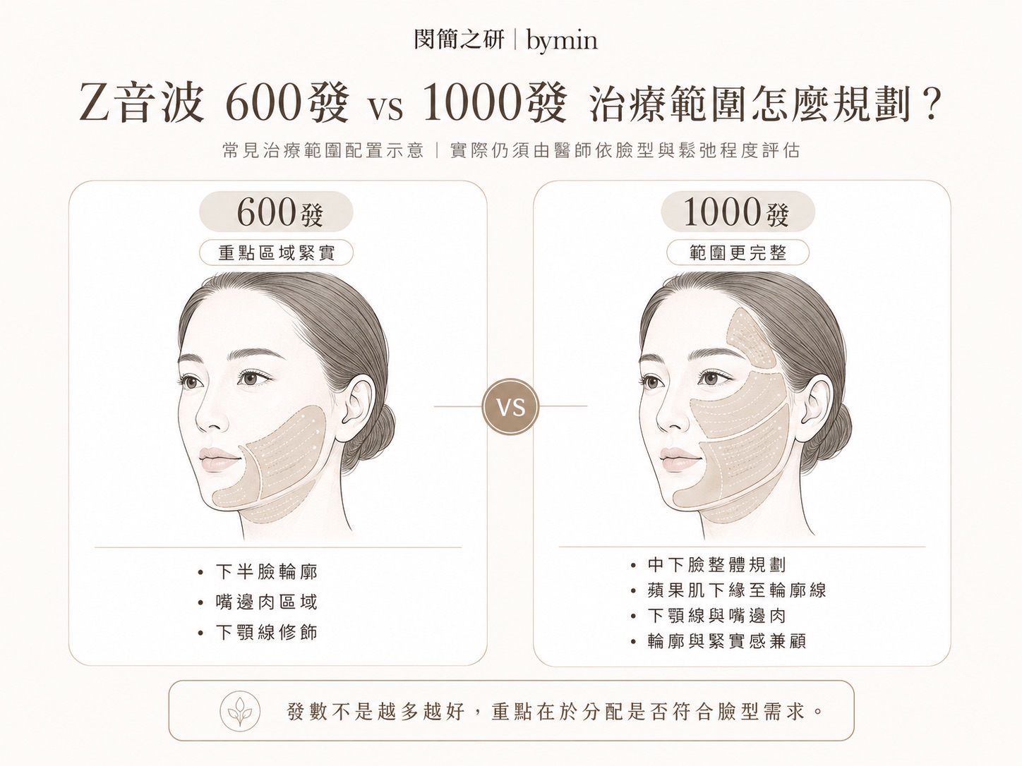 Z音波600發與1000發治療範圍配置比較