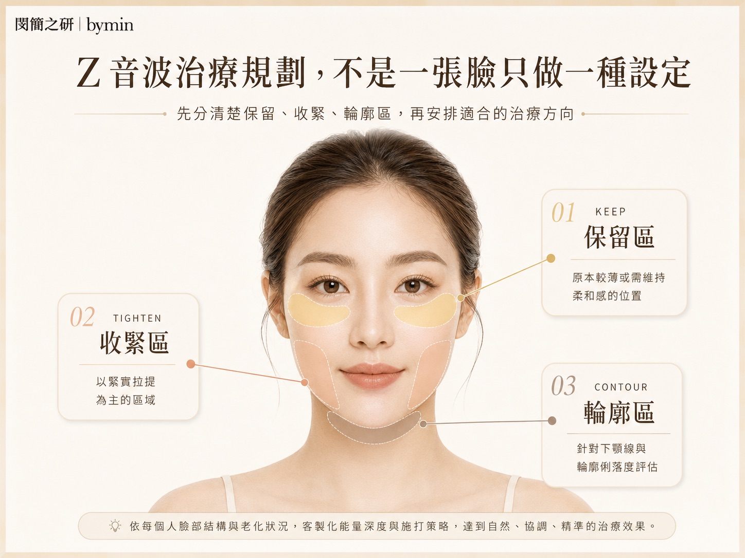 Z音波保留區收緊區與輪廓區治療規劃示意