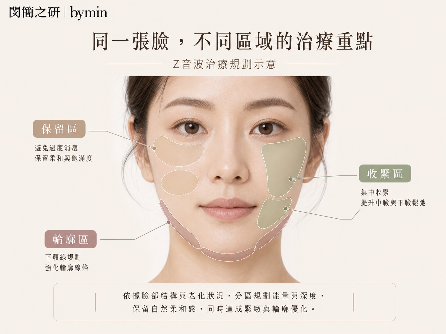 Z音波同一張臉不同區域保留收緊與輪廓規劃示意
